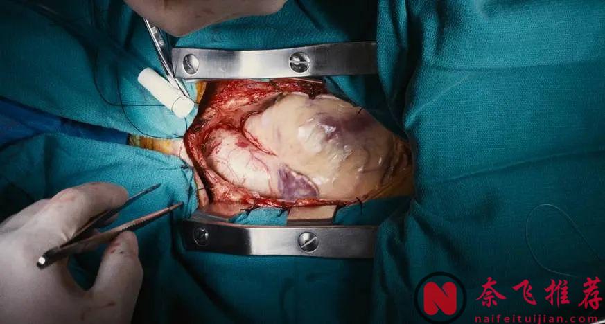 荒诞、诡异，这部悬疑片《圣鹿之死/圣鹿猎杀》看完让人头皮发麻！