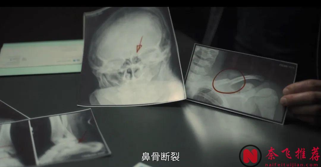 强烈建议不要晚上观看这部由Netfilx出品的惊悚剧《寒栗/栗子人杀手》！