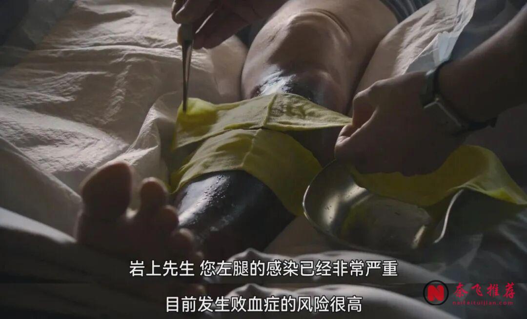 觀眾吵翻了,《廢用身》離得這名醫生到底是善人還是惡魔!